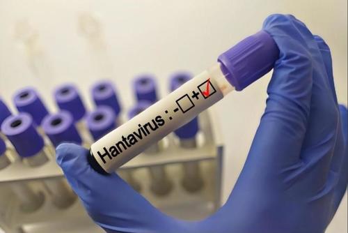 Salud descarta circulación activa de hantavirus en Guatemala.